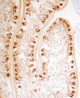 Immunohistochemistry PLA2G2A Antibody [Unconjugated]