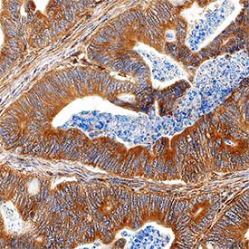 Immunohistochemistry PLA2G4A Antibody [Unconjugated]