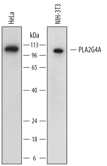 Western Blot PLA2G4A Antibody [Unconjugated]