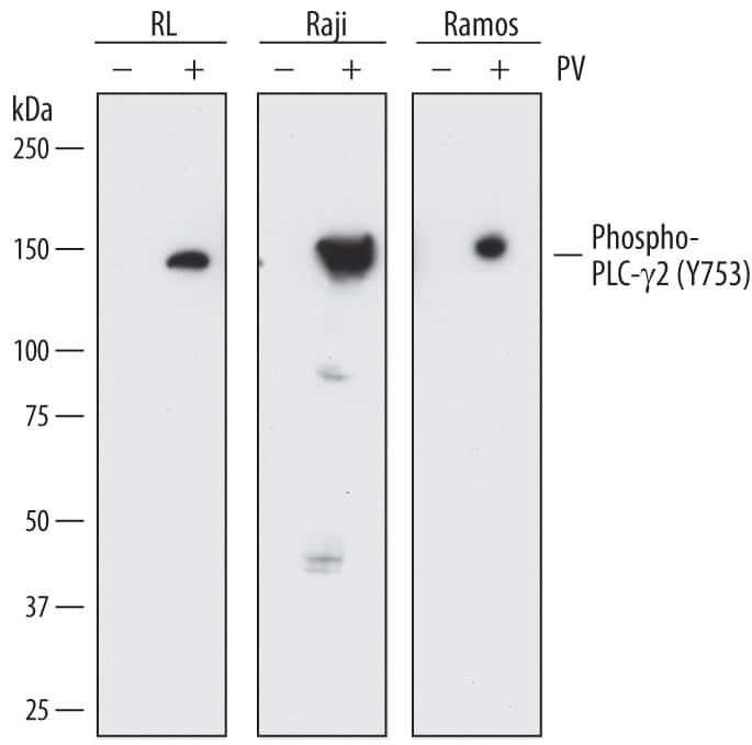 Western blot shows lysates of RL human non-Hodgkin's lymphoma B cell line, Raji human Burkitt's lymphoma cell line, and Ramos human Burkitt's lymphoma cell line untreated (-) or treated (+) with 1 mM Pervanadate (PV) for 10 minutes. PVDF membrane was probed with 0.5 µg/mL of Mouse Anti-Human Phospho-PLC- gamma2 (Y753) Monoclonal Antibody (Catalog # MAB37161) followed by HRP-conjugated Anti-Mouse IgG Secondary Antibody (Catalog # HAF018). A specific band was detected for Phospho-PLC- gamma2 (Y753) at approximately 150 kDa (as indicated). This experiment was conducted under reducing conditions and using Immunoblot Buffer Group 1.