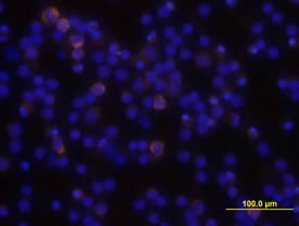 PLC- gamma2 was detected in immersion fixed human peripheral blood mononuclear cells (PBMCs) using Human/Mouse PLC- gamma2 Monoclonal Antibody (Catalog # MAB3716) at 10 µg/mL for 3 hours at room temperature. Cells were stained using the NorthernLights™ 557-conjugated Anti-Mouse IgG Secondary Antibody (yellow; Catalog # NL007) and counterstained with DAPI (blue). View our protocol for Fluorescent ICC Staining of Non-adherent Cells.
