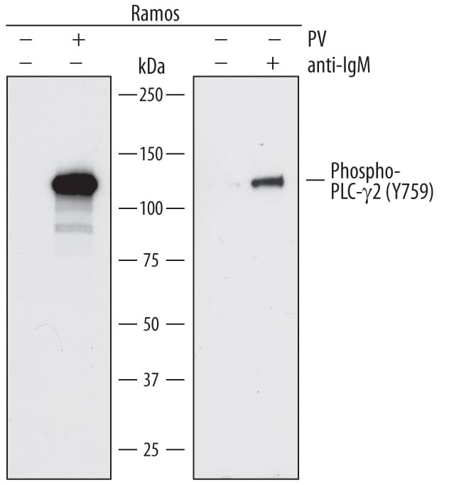 Western blot shows lysates of Ramos human Burkitt's lymphoma cell line untreated (-) or treated (+) with 100 µM Pervanadate (PV) for 10 minutes or 10 µg/mL Goat Anti-Human IgM µ Chain Antigen Affinity-purified Polyclonal Antibody (Catalog # G-105-C) for 2 minutes. PVDF membrane was probed with 0.2 µg/mL of Mouse Anti-Human Phospho-PLC- gamma2 (Y759) Monoclonal Antibody (Catalog # MAB7377) followed by HRP-conjugated Anti-Mouse IgG Secondary Antibody (Catalog # HAF007). A specific band was detected for Phospho-PLC- gamma2 (Y759) at approximately 130 kDa (as indicated). This experiment was conducted under reducing conditions and using Immunoblot Buffer Group 1.
