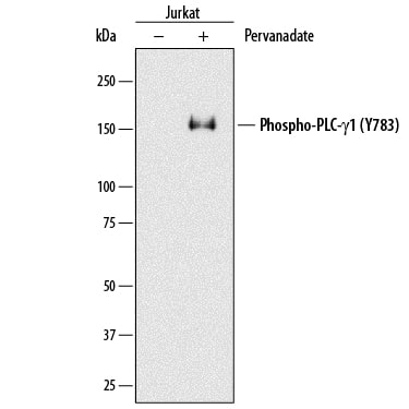 Western blot shows lysates of Jurkat human acute T cell leukemia cell line untreated (-) or treated (+) with 1 mM Pervanadate (PV) for 5 minutes. PVDF membrane was probed with 0.05 µg/mL of Rabbit Anti-Human/Mouse/Rat Phospho-PLC- gamma1 (Y783) Monoclonal Antibody (Catalog # MAB74541) followed by HRP-conjugated Anti-Rabbit IgG Secondary Antibody (Catalog # HAF008). A specific band was detected for Phospho-PLC- gamma1 (Y783) at approximately 150 kDa (as indicated). This experiment was conducted under reducing conditions and using Immunoblot Buffer Group 1.