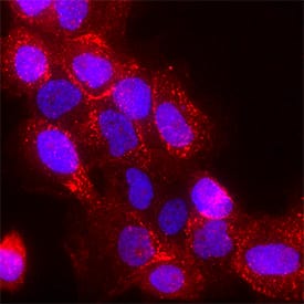 PLC- gamma1 phosphorylated at Y783 was detected in immersion fixed A431 human epithelial carcinoma cell line treated with Recombinant Human EGF (Catalog # 236-EG) using Rabbit Anti-Human Phospho-PLC- gamma1 (Y783) Polyclonal Antibody (Catalog # MAB74542) at 3 µg/mL for 3 hours at room temperature. Cells were stained using the NorthernLights™ 557-conjugated Anti-Rabbit IgG Secondary Antibody (red; Catalog # NL004) and counterstained with DAPI (blue). Specific staining was localized to cytoplasm and plasma membranes. View our protocol for Fluorescent ICC Staining of Cells on Coverslips.