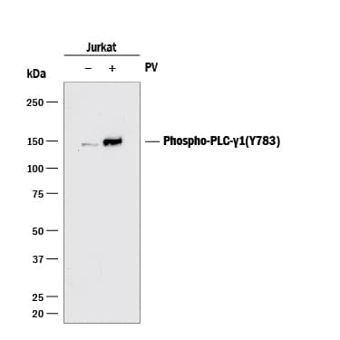Western blot shows lysates of Jurkat human acute T cell leukemia cell line untreated (-) or treated (+) with 1 mM Pervanadate (PV) for 5 minutes. PVDF membrane was probed with 1 µg/mL of Mouse Anti-Human Phospho-PLC- gamma1 (Y783) Monoclonal Antibody (Catalog # MAB7454) followed by HRP-conjugated Anti-Mouse IgG Secondary Antibody (Catalog # HAF018). A specific band was detected for Phospho-PLC- gamma1 (Y783) at approximately 150 kDa (as indicated). This experiment was conducted under reducing conditions and using Immunoblot Buffer Group 1.