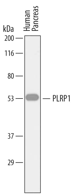 Western blot shows lysates of human pancreas tissue. PVDF membrane was probed with 1 µg/mL of Sheep Anti-Human PLRP1 Antigen Affinity-purified Polyclonal Antibody (Catalog # AF7105) followed by HRP-conjugated Anti-Sheep IgG Secondary Antibody (Catalog # HAF016). A specific band was detected for PLRP1 at approximately 53 kDa (as indicated). This experiment was conducted under reducing conditions and using Immunoblot Buffer Group 1.