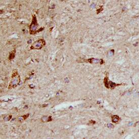 Immunohistochemistry PLTP Antibody