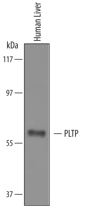Western Blot PLTP Antibody [Unconjugated]