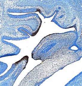 Immunohistochemistry PLUNC Antibody