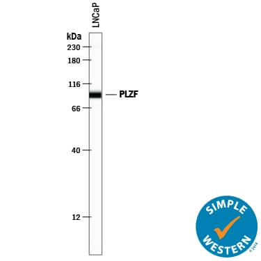 Simple Western PLZF Antibody [Unconjugated]