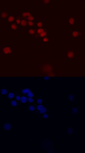 PLZF was detected in immersion fixed HL-60 human acute promyelocytic leukemia cell line using Human PLZF Monoclonal Antibody (Catalog # MAB2944) at 10 µg/mL for 3 hours at room temperature. Cells were stained using the NorthernLights™ 557-conjugated Anti-Mouse IgG Secondary Antibody (red, upper panel; Catalog # NL007) and counterstained with DAPI (blue, lower panel). Specific staining was localized to nuclei. View our protocol for Fluorescent ICC Staining of Non-adherent Cells.