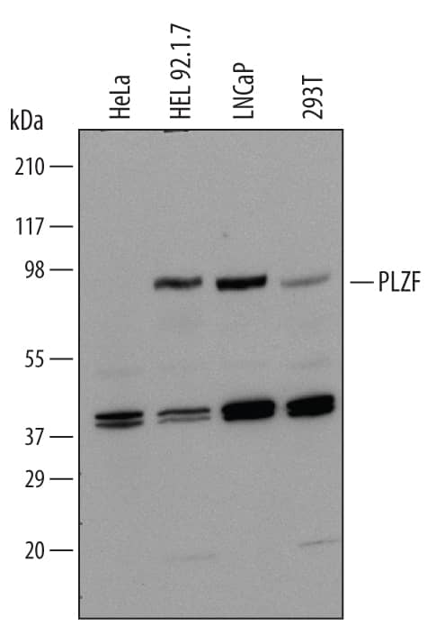 Western blot shows lysates of HeLa human cervical epithelial carcinoma cell line, HEL 92.1.7 human erythroleukemic cell line, LNCaP human prostate cancer cell line, and 293T human embryonic kidney cell line. PVDF Membrane was probed with 1 µg/mL of Human PLZF Monoclonal Antibody (Catalog # MAB2944) followed by HRP-conjugated Anti-Mouse IgG Secondary Antibody (Catalog # HAF007). A specific band was detected for PLZF at approximately 85 kDa (as indicated). This experiment was conducted under reducing conditions and using Immunoblot Buffer Group 1.