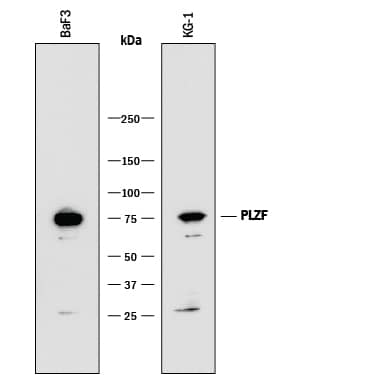 Western blot shows lysates of BaF3 mouse pro-B cell line and KG-1 human acute myelogenous leukemia cell line. PVDF membrane was probed with 1 µg/mL of Rat Anti-Mouse PLZF Monoclonal Antibody (Catalog # MAB8395) followed by HRP-conjugated Anti-Rat IgG Secondary Antibody (Catalog # HAF005). A specific band was detected for PLZF at approximately 75 kDa (as indicated). This experiment was conducted under reducing conditions and using Immunoblot Buffer Group 1.