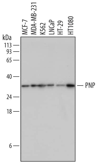 Western Blot Purine Nucleoside Phosphorylase/PNP Antibody [Unconjugated]