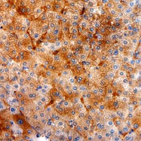 Immunohistochemistry Purine Nucleoside Phosphorylase/PNP Antibody (773511)