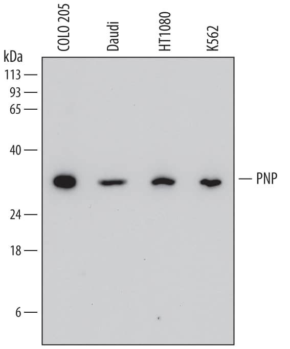 Western Blot Purine Nucleoside Phosphorylase/PNP Antibody (773511)