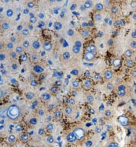 Protein O-Glucosyltransferase 1/POGLUT was detected in immersion fixed paraffin-embedded sections of human liver using Mouse Anti-Human Protein O-Glucosyltransferase 1/POGLUT Monoclonal Antibody (Catalog # MAB64371) at 15 µg/mL overnight at 4 °C. Before incubation with the primary antibody, tissue was subjected to heat-induced epitope retrieval using Antigen Retrieval Reagent-Basic (Catalog # CTS013). Tissue was stained using the Anti-Mouse HRP-DAB Cell & Tissue Staining Kit (brown; Catalog # CTS002) and counterstained with hematoxylin (blue). Specific staining was localized to the cytoplasm of hepatocytes. View our protocol for Chromogenic IHC Staining of Paraffin-embedded Tissue Sections.