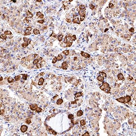 POMC was detected in immersion fixed paraffin-embedded sections of human pituitary using Mouse Anti-Human POMC Monoclonal Antibody (Catalog # MAB9498) at 5 µg/mL for 1 hour at room temperature followed by incubation with the Anti-Mouse IgG VisUCyte™ HRP Polymer Antibody (Catalog # VC001). Tissue was stained using DAB (brown) and counterstained with hematoxylin (blue). Specific staining was localized to corticotroph cells. View our protocol for IHC Staining with VisUCyte HRP Polymer Detection Reagents.
