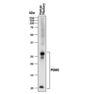 Western blot shows lysates of human pituitary gland tissue. PVDF membrane was probed with 0.5 µg/mL of Mouse Anti-Human POMC Monoclonal Antibody (Catalog # MAB9498) followed by HRP-conjugated Anti-Mouse IgG Secondary Antibody (Catalog # HAF018). Specific bands were detected for POMC at approximately 10-30 kDa (as indicated). This experiment was conducted under reducing conditions and using Immunoblot Buffer Group 1.