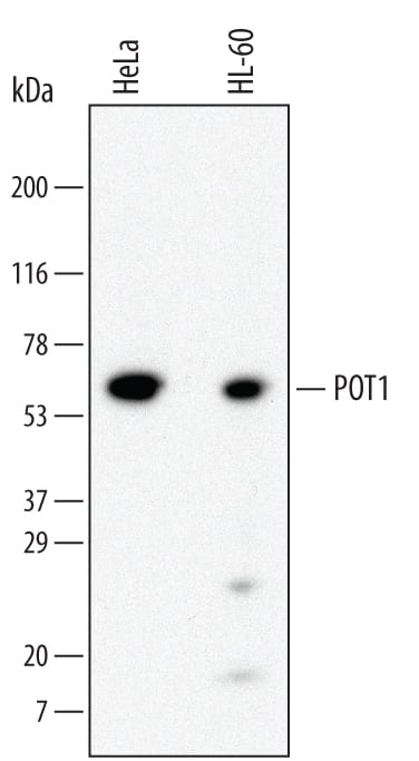 Western Blot POT1 Antibody (688923)