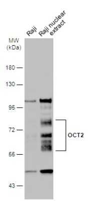 Western Blot: POU2F2 Antibody [NBP3-13282] - Raji whole cell and nuclear extracts (30 ug) were separated by 7.5% SDS-PAGE, and the membrane was blotted with POU2F2 antibody (NBP3-13282) diluted at 1:1000. The HRP-conjugated anti-rabbit IgG antibody (NBP2-19301) was used to detect the primary antibody.