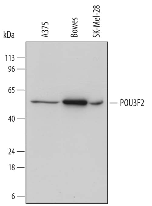 Western blot shows lysates of A375 human melanoma cell line, Bowes human melanoma cell line, and SK-Mel-28 human malignant melanoma cell line. PVDF membrane was probed with 1 µg/mL of Mouse Anti-Human POU3F2 Monoclonal Antibody (Catalog # MAB7427) followed by HRP-conjugated Anti-Mouse IgG Secondary Antibody (Catalog # HAF018). A specific band was detected for POU3F2 at approximately 47 kDa (as indicated). This experiment was conducted under reducing conditions and using Immunoblot Buffer Group 1.