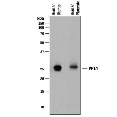 Western Blot PP14/Glycodelin Antibody [Unconjugated]