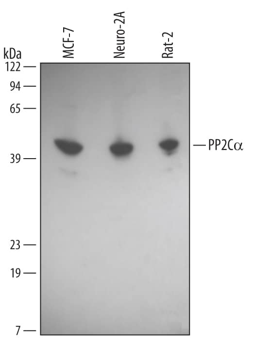 Western blot shows lysates of MCF-7 human breast cancer cell line, Neuro-2A mouse neuroblastoma cell line, and Rat-2 rat embryonic fibroblast cell line. PVDF Membrane was probed with 1 µg/mL of Mouse Anti-Human/Mouse/Rat PP2Ca/ PPM1A Monoclonal Antibody (Catalog # MAB4150) followed by HRP-conjugated Anti-Mouse IgG Secondary Antibody (Catalog # HAF007). A specific band was detected for PP2Ca/PPM1A at approximately 41 kDa (as indicated). This experiment was conducted under reducing conditions and using Immunoblot Buffer Group 1.