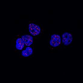 PPARa/NR1C1 was detected in immersion fixed HT-29 human colon adenocarcinoma cell line using Rabbit Anti-Human PPARa/NR1C1 Monoclonal Antibody (Catalog # MAB24781) at 3 µg/mL for 3 hours at room temperature. Cells were stained using the NorthernLights™ 557-conjugated Anti-Rabbit IgG Secondary Antibody (red; Catalog # NL004) and counterstained with DAPI (blue). Specific staining was localized to nuclei. View our protocol for Fluorescent ICC Staining of Cells on Coverslips.