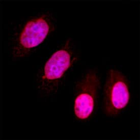 PPM1D was detected in immersion fixed MCF-7 human breast cancer cell line using Sheep Anti-Human PPM1D Antigen Affinity-purified Polyclonal Antibody (Catalog # AF10120) at 1.7 µg/mL for 3 hours at room temperature. Cells were stained using the NorthernLights™ 557-conjugated Anti-Sheep IgG Secondary Antibody (red; NL010) and counterstained with DAPI (blue). Specific staining was localized to nuclei. View our protocol for Fluorescent ICC Staining of Cells on Coverslips.