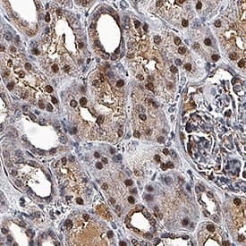 PPM1D was detected in immersion fixed paraffin-embedded sections of human kidney using Sheep Anti-Human PPM1D Antigen Affinity-purified Polyclonal Antibody (Catalog # AF10120) at 3 µg/mL for 1 hour at room temperature followed by incubation with the Anti-Sheep IgG VisUCyte™ HRP Polymer Antibody (Catalog # VC006). Before incubation with the primary antibody, tissue was subjected to heat-induced epitope retrieval using Antigen Retrieval Reagent-Basic (Catalog # CTS013). Tissue was stained using DAB (brown) and counterstained with hematoxylin (blue). Specific staining was localized to nuclei. View our protocol for IHC Staining with VisUCyte HRP Polymer Detection Reagents.