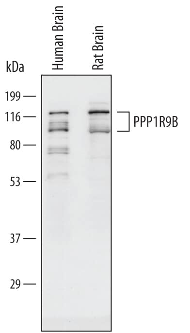 Western Blot PPP1R9B/Spinophilin Antibody