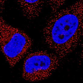 PRAS40 was detected in immersion fixed HeLa human cervical epithelial carcinoma cell line using Mouse Anti-Human PRAS40 Monoclonal Antibody (Catalog # MAB6408) at 8 µg/mL for 3 hours at room temperature. Cells were stained using the NorthernLights™ 557-conjugated Anti-Mouse IgG Secondary Antibody (red; Catalog # NL007) and counterstained with DAPI (blue). Specific staining was localized to cytoplasm. View our protocol for Fluorescent ICC Staining of Cells on Coverslips.