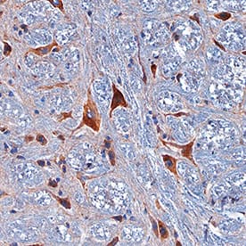 Immunohistochemistry PRAT4A/TNRC5 Antibody [Unconjugated]