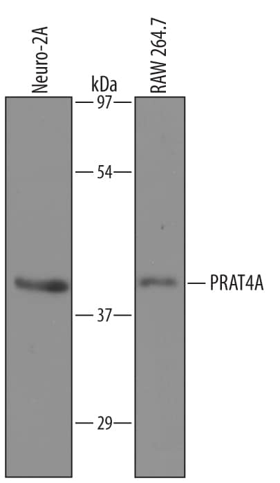 Western Blot PRAT4A/TNRC5 Antibody [Unconjugated]
