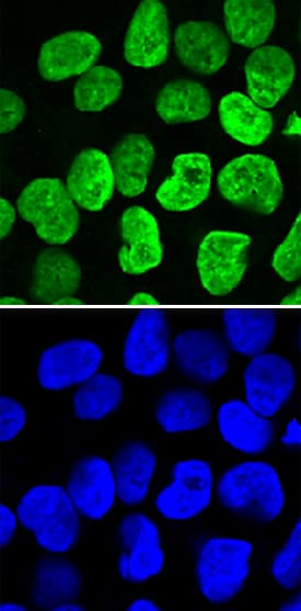 Immunocytochemistry PRDM14 Antibody [Unconjugated]