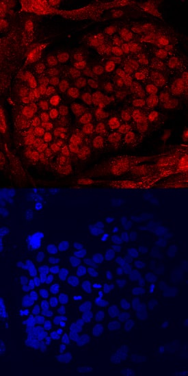 PRDM14 was detected in fixed BG01V human embryonic stem cells grown on irradiated MEF cells using Human PRDM14 Monoclonal Antibody (Catalog # MAB6175) at 10 µg/mL for 3 hours at room temperature. Cells were stained using the NorthernLights™ 557-conjugated Anti-Mouse IgG Secondary Antibody (red, upper panel; Catalog # NL007) and counterstained with DAPI (blue, lower panel). Specific staining was localized to nuclei. View our protocol for Fluorescent ICC Staining of Cells on Coverslips.