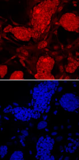 PRDM14 was detected in immersion fixed D3 mouse embryonic stem cells using Rat Anti-Mouse PRDM14 Monoclonal Antibody (Catalog # MAB8097) at 10 µg/mL for 3 hours at room temperature. Cells were stained using the NorthernLights™ 557-conjugated Anti-Rat IgG Secondary Antibody (red; Catalog # NL013) and counterstained with DAPI (blue). Specific staining was localized to nuclei. View our protocol for Fluorescent ICC Staining of Stem Cells on Coverslips.