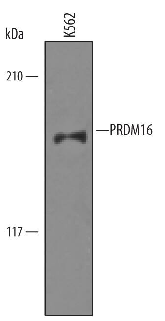 Western blot shows lysates of K562 human chronic myelogenous leukemia cell line. PVDF Membrane was probed with 1 µg/mL of Sheep Anti-Human/Mouse PRDM16 Antigen Affinity-purified Polyclonal Antibody (Catalog # AF6295) followed by HRP-conjugated Anti-Sheep IgG Secondary Antibody (Catalog # HAF016). A specific band was detected for PRDM16 at approximately 170 kDa (as indicated). This experiment was conducted under reducing conditions and using Immunoblot Buffer Group 8.
