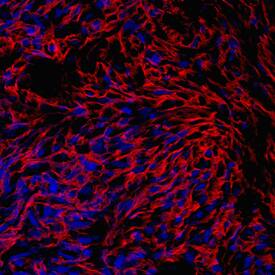 PRELP was detected in immersion fixed human mesenchymal stem cells differentiated into chondrocytes using Sheep Anti-Human PRELP Antigen Affinity-purified Polyclonal Antibody (Catalog # AF6447) at 10 µg/mL overnight at 4 °C. Cells were stained using the NorthernLights™ 557-conjugated Anti-Sheep IgG Secondary Antibody (red; Catalog # NL010) and counterstained with DAPI (blue). Specific staining was localized to cytoplasm. View our protocol for Fluorescent ICC Staining of Cells on Coverslips.
