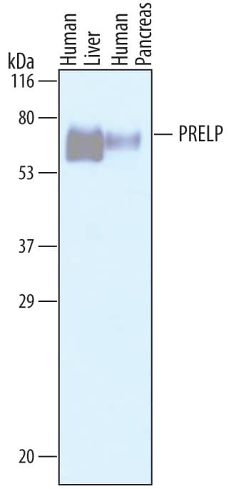 Western Blot PRELP Antibody [Unconjugated]
