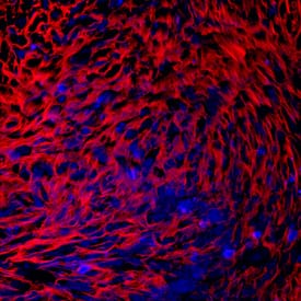 PRELP was detected in immersion fixed human mesenchymal stem cells differentiated into chondrocytes using Mouse Anti-Human PRELP Monoclonal Antibody (Catalog # MAB6447) at 10 µg/mL for 3 hours at room temperature. Cells were stained using the NorthernLights™ 557-conjugated Anti-Mouse IgG Secondary Antibody (red; Catalog # NL007) and counterstained with DAPI (blue). Specific staining was localized to cytoplasm. View our protocol for Fluorescent ICC Staining of Cells on Coverslips.