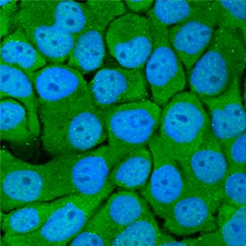 PRKD3/nPKC nu was detected in immersion fixed MCF-7 human breast cancer cell line using Sheep Anti-Human PRKD3/nPKC nu Antigen Affinity-purified Polyclonal Antibody (Catalog # AF6478) at 10 µg/mL for 3 hours at room temperature. Cells were stained using the NorthernLights™ 493-conjugated Anti-Sheep IgG Secondary Antibody (green; Catalog # NL012) and counterstained with DAPI (blue). Specific staining was localized to cytoplasm and nuclei. View our protocol for Fluorescent ICC Staining of Cells on Coverslips.