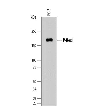Western Blot P-Rex1 Antibody (869704) [Unconjugated]