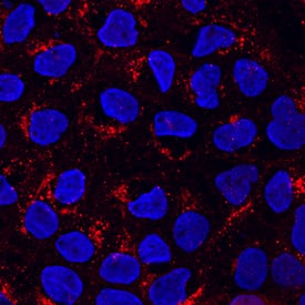 PSAP was detected in immersion fixed A431 human epithelial carcinoma cell line using Rabbit Anti-Human PSAP Antigen Affinity-purified Polyclonal Antibody (Catalog # AF8520) at 1:100 dilution for 3 hours at room temperature. Cells were stained using the NorthernLights™ 557-conjugated Anti-Rabbit IgG Secondary Antibody (red; Catalog # NL004) and counterstained with DAPI (blue). Specific staining was localized to Golgi. View our protocol for Fluorescent ICC Staining of Cells on Coverslips.