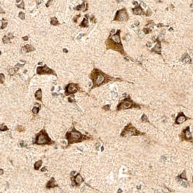 PSENEN was detected in immersion fixed paraffin-embedded sections of human Alzheimer's brain using Mouse Anti-Human PSENEN Monoclonal Antibody (Catalog # MAB6859) at 15 µg/mL overnight at 4 °C. Before incubation with the primary antibody, tissue was subjected to heat-induced epitope retrieval using Antigen Retrieval Reagent-Basic (Catalog # CTS013). Tissue was stained using the Anti-Mouse HRP-DAB Cell & Tissue Staining Kit (brown; Catalog # CTS002) and counterstained with hematoxylin (blue). Specific staining was localized to cytoplasm and neurites of neurons. View our protocol for Chromogenic IHC Staining of Paraffin-embedded Tissue Sections.