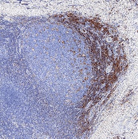 PSGL-1/CD162 was detected in immersion fixed paraffin-embedded sections of human tonsil using Sheep Anti-Human PSGL-1/CD162 Antigen Affinity-purified Polyclonal Antibody (Catalog # AF3345) at 3 µg/mL overnight at 4 °C. Tissue was stained using the Anti-Sheep HRP-DAB Cell & Tissue Staining Kit (brown; Catalog # CTS019) and counterstained with hematoxylin (blue). Specific staining was localized to lymphocytes. View our protocol for Chromogenic IHC Staining of Paraffin-embedded Tissue Sections.