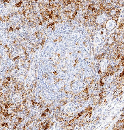 PSGL-1/CD162 was detected in immersion fixed paraffin-embedded sections of human tonsil using Mouse Anti-Human PSGL-1/CD162 Monoclonal Antibody (Catalog # MAB3345) at 5 µg/mL for 1 hour at room temperature followed by incubation with the Anti-Mouse IgG VisUCyte™ HRP Polymer Antibody (Catalog # VC001). Before incubation with the primary antibody, tissue was subjected to heat-induced epitope retrieval using Antigen Retrieval Reagent-Basic (Catalog # CTS013). Tissue was stained using DAB (brown) and counterstained with hematoxylin (blue). Specific staining was localized to cytoplasm in lymphocytes. View our protocol for IHC Staining with VisUCyte HRP Polymer Detection Reagents.