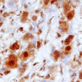Immunohistochemistry PSMA1 Antibody