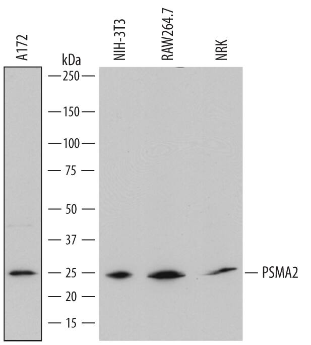 Western blot shows lysates of A172 human glioblastoma cell line, NIH-3T3 mouse embryonic fibroblast cell line, RAW 264.7 mouse monocyte/macrophage cell line, and NRK rat normal kidney cell line. PVDF membrane was probed with 0.2 µg/mL of Sheep Anti-Human/Mouse/Rat PSMA2 Antigen Affinity-purified Polyclonal Antibody (Catalog # AF7639) followed by HRP-conjugated Anti-Sheep IgG Secondary Antibody (Catalog # HAF016). A specific band was detected for PSMA2 at approximately 25 kDa (as indicated). This experiment was conducted under reducing conditions and using Immunoblot Buffer Group 1.